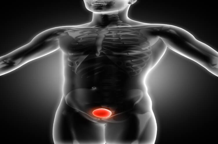 precio de hernia inguinal en, cd juarez